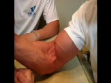 Thumb 9
