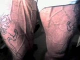 Vascularity