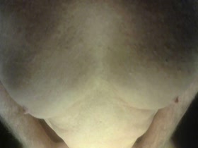 Thumb 17