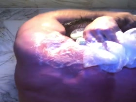 Thumb 13
